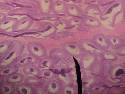 Epididymis - histology slide
This is a histology slide of the epididymis. 

Image by Jpogi at Wikipedia, via Wikimedia Commons. Public domain.

No changes were made to the original image downloaded (note: this version was downloaded at reduced resolution from Wikimedia Commons).


