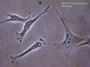 Filename=Fibroblast.jpg
Filesize=45KiB
Dimensions=600x450
Date added=Oct 01, 2025 Fibroblast.jpg