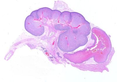 Fetal kidney - histology slide
Whole slide from fetal tissue (23° week). Kidney, adrenal gland, proximal urether are visible. Scanned slide (Epson Perfection 1670), H&E. (Description text from the Wikimedia Commons file page.)

Source: Slide files from Hospital of Monfalcone (Italy)
Author:  Alex_brollo, via Wikimedia Commons. 

Original file source: [url=https://commons.wikimedia.org/wiki/File:Fetal_kidney_23_weeks.jpg]https://commons.wikimedia.org/wiki/File:Fetal_kidney_23_weeks.jpg[/url]

Title: "Fetal_kidney_23_weeks.jpg"

No changes were made to the original image downloaded (downloaded at reduced resolution from Wikimedia Commons).

Permission is granted to copy, distribute and/or modify this document under the terms of the GNU Free Documentation License, Version 1.2 or any later version published by the Free Software Foundation; with no Invariant Sections, no Front-Cover Texts, and no Back-Cover Texts. A copy of the license is included in the section entitled GNU Free Documentation License. [url=https://commons.wikimedia.org/wiki/Commons:GNU_Free_Documentation_License,_version_1.2]https://commons.wikimedia.org/wiki/Commons:GNU_Free_Documentation_License,_version_1.2[/url]

This file is licensed under the Creative Commons Attribution-Share Alike 3.0 Unported license. [url=https://creativecommons.org/licenses/by-sa/3.0/deed.en/]https://creativecommons.org/licenses/by-sa/3.0/deed.en/[/url]


Keywords: kidney
