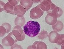 Basophil - histology slide
Image by Department of Histology, Jagiellonian University Medical College ([url=http://histologia.cm-uj.krakow.pl/index.html]1[/url]; [url=https://web.archive.org/web/20060216212659/http://www.histologia.cm-uj.krakow.pl/index.html]archive copy[/url] at the Wayback Machine), via Wikimedia Commons.

Original file source: [url=https://commons.wikimedia.org/wiki/File:Basophil.jpg]https://commons.wikimedia.org/wiki/File:Basophil.jpg[/url]

Title: "Basophil.jpg"

No changes were made to the original image downloaded. 

Permission is granted to copy, distribute and/or modify this document under the terms of the GNU Free Documentation License, Version 1.2 or any later version published by the Free Software Foundation; with no Invariant Sections, no Front-Cover Texts, and no Back-Cover Texts. A copy of the license is included in the section entitled GNU Free Documentation License. [url=https://commons.wikimedia.org/wiki/Commons:GNU_Free_Documentation_License,_version_1.2]https://commons.wikimedia.org/wiki/Commons:GNU_Free_Documentation_License,_version_1.2[/url]

This file is licensed under the Creative Commons Attribution-Share Alike 3.0 Unported License [url=https://creativecommons.org/licenses/by-sa/3.0/deed.en/]https://creativecommons.org/licenses/by-sa/3.0/deed.en/[/url]



