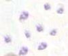 Filename=Blood_platelets.jpg
Filesize=3KiB
Dimensions=200x167
Date added=Oct 29, 2025 Blood_platelets.jpg