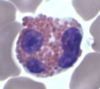 WBC_eosinophil.jpg