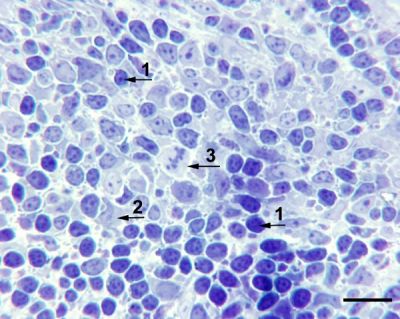 Pineal gland, chicken – histology slide
High magnification of PALT. Toluidine-blue stained 1 μm epoxy section of PALT at higher magnification showing numerous small lymphocytes (1), and larger pleomorphic cells (2). Mitotic figures were common (3). Bar indicates 10 μm.

Citation: Mosenson, J.A., McNulty, J.A. Characterization of lymphocyte subsets over a 24-hour period in Pineal-Associated Lymphoid Tissue (PALT) in the chicken. BMC Immunol 7, 1 (2006). https://doi.org/10.1186/1471-2172-7-1

Source: [url=https://bmcimmunol.biomedcentral.com/articles/10.1186/1471-2172-7-1]BMC Immunology article[/url]

Image title: "Figure 2"

No changes were made to the original image downloaded.  

This image and descriptive text are from an article published by [i]BioMed Central Ltd[/i]. It is an Open Access article distributed under the terms of the [url=https://creativecommons.org/licenses/by/2.0]Creative Commons Attribution License (CC BY 2.0)[/url], which permits unrestricted use, distribution, and reproduction in any medium, provided the original work is properly cited.  

Keywords: pineal