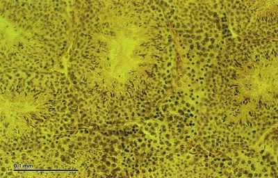 Testes, mouse - histology slide 
Testicles: Cross-section; mouse. Optical microscopy technique: Bright field. Magnification: 600x (for picture width 26 cm ~ A4 format). (Description text from the Wikimedia Commons file page.)

Image by [url=https://cs.wikipedia.org/wiki/Josef_Reischig]Josef Reischig[/url], via Wikimedia Commons. 

Source: Author's archive

Original file source: [url=https://commons.wikimedia.org/wiki/File:Testicles_%28265_20%29_Cross-section%3B_mouse.jpg]https://commons.wikimedia.org/wiki/File:Testicles_%28265_20%29_Cross-section%3B_mouse.jpg[/url]

Title: "Testicles_(265_20)_Cross-section;_mouse.jpg"

No changes were made to the original image downloaded (note: this version was downloaded at reduced resolution from Wikimedia Commons).

The heirs of the creator of this work hereby publish it under the following license:
This file is licensed under the Creative Commons Attribution-Share Alike 3.0 Unported license [url=https://creativecommons.org/licenses/by-sa/3.0/deed.en/]https://creativecommons.org/licenses/by-sa/3.0/deed.en/[/url]

Keywords: testes
