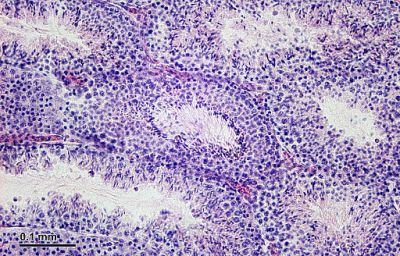 Testes, mouse - histology slide 
Testicles: Testicles cross-section (mouse). Optical microscopy technique: Bright field. Magnification: 360x (for picture width 26 cm ~ A4 format). (Description text from the Wikimedia Commons file page.)

Image by [url=https://cs.wikipedia.org/wiki/Josef_Reischig]Josef Reischig[/url], via Wikimedia Commons. 

Source: Author's archive

Original file source: [url=https://commons.wikimedia.org/wiki/File:Testicles_(26_2_15)_Testicles_cross-section_(mouse).jpg]https://commons.wikimedia.org/wiki/File:Testicles_(26_2_15)_Testicles_cross-section_(mouse).jpg[/url]

Title: "Testicles (26 2 15) Testicles cross-section (mouse).jpg"

No changes were made to the original image downloaded (note: this version was downloaded at reduced resolution from Wikimedia Commons).

The heirs of the creator of this work hereby publish it under the following license:
This file is licensed under the Creative Commons Attribution-Share Alike 3.0 Unported License [url=https://creativecommons.org/licenses/by-sa/3.0/deed.en/]https://creativecommons.org/licenses/by-sa/3.0/deed.en/[/url]

Keywords: testes