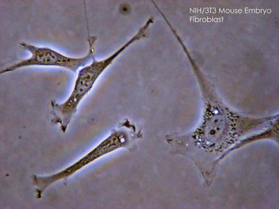 Fibroblasts, mouse embryo
Fibroblasts seen with phase contrast microscopy.

Courtesy of SubtleGuest, via Wikimedia Commons. No changes were made from the download.  

Original file source: [url=https://commons.wikimedia.org/wiki/File:Fibroblast.jpg]https://commons.wikimedia.org/wiki/File:Fibroblast.jpg[/url]

Permission is granted to copy, distribute and/or modify this document under the terms of the GNU Free Documentation License, Version 1.2 or any later version published by the Free Software Foundation; with no Invariant Sections, no Front-Cover Texts, and no Back-Cover Texts. A copy of the license is included in the section entitled GNU Free Documentation License. [url=https://commons.wikimedia.org/wiki/Commons:GNU_Free_Documentation_License,_version_1.2]https://commons.wikimedia.org/wiki/Commons:GNU_Free_Documentation_License,_version_1.2[/url]

This file is licensed under the Creative Commons Attribution 2.5 Generic license. [url=https://creativecommons.org/licenses/by/2.5/deed.en/]https://creativecommons.org/licenses/by/2.5/deed.en/[/url]

This file is licensed under the Creative Commons Attribution-Share Alike 3.0 Unported license. [url=https://creativecommons.org/licenses/by-sa/3.0/deed.en/]https://creativecommons.org/licenses/by-sa/3.0/deed.en/[/url]

Keywords: fetal connective fibers