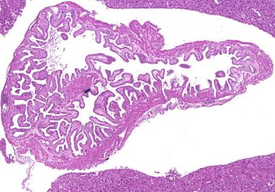 Gallbladder, mouse - histology slide
A normal, empty mouse gallbladder. (Description text from the Wikimedia Commons file page.)

Image by Laboratory of Experimental Pathology, Division of Intramural Research, NIEHS (NIH), via Wikimedia Commons. Public domain.

No changes were made to the original image downloaded.  

