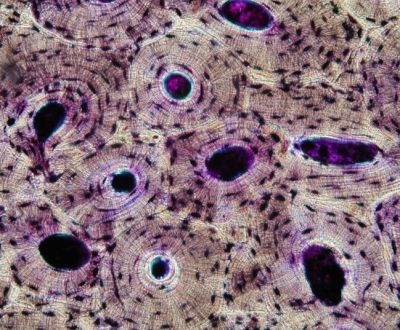 Compact bone – histology slide
Histology slide courtesy of Department of Histology, Jagiellonian University Medical College and Wikimedia Commons. No changes were made from the download.  

Original file source:
[url=https://commons.wikimedia.org/wiki/File:Compact_bone_-_ground_cross_section.jpg]https://commons.wikimedia.org/wiki/File:Compact_bone_-_ground_cross_section.jpg[/url]

Licenses: Creative Commons Attribution-Share Alike 3.0 Unported and GNU Free Documentation License, version 1.2 or later (see [url=https://www.histology-world.com/credits/credits.htm]Licenses and Credits[/url] for links to licenses).

