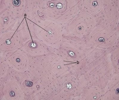 Compact bone, decalcified (labels) - histology slide
Latin names of structures shown on figure:
a - canalis osteoni s. Haversi
b - osteocytus
(Description text from the Wikimedia Commons file page.)

Image by Department of Histology, Jagiellonian University Medical College ([url=http://histologia.cm-uj.krakow.pl/index.html]1[/url]; [url=https://web.archive.org/web/20060216212659/http://www.histologia.cm-uj.krakow.pl/index.html]archive copy[/url] at the Wayback Machine), via Wikimedia Commons.

Original file source: [url=https://commons.wikimedia.org/wiki/File:Compact_bone_-_decalcified_cross_section.jpg]https://commons.wikimedia.org/wiki/File:Compact_bone_-_decalcified_cross_section.jpg[/url]
Title: "Compact bone - decalcified cross section.jpg"

No changes were made to the original image downloaded. 

Permission is granted to copy, distribute and/or modify this document under the terms of the GNU Free Documentation License, Version 1.2 or any later version published by the Free Software Foundation; with no Invariant Sections, no Front-Cover Texts, and no Back-Cover Texts. A copy of the license is included in the section entitled GNU Free Documentation License. [url=https://commons.wikimedia.org/wiki/Commons:GNU_Free_Documentation_License,_version_1.2]https://commons.wikimedia.org/wiki/Commons:GNU_Free_Documentation_License,_version_1.2[/url]

This file is licensed under the Creative Commons Attribution-Share Alike 3.0 Unported License [url=https://creativecommons.org/licenses/by-sa/3.0/deed.en/]https://creativecommons.org/licenses/by-sa/3.0/deed.en/[/url]



