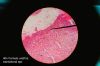 Filename=Female_urethra_histology.jpg
Filesize=109KiB
Dimensions=1024x680
Date added=Sep 28, 2025 Female_urethra_histology.jpg