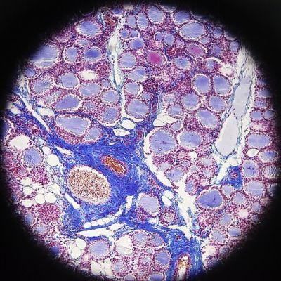 Thyroid gland - histology slide
This is a histology slide of the thyroid gland. 

Histology slide courtesy of Lazar.zenit and Wikimedia Commons. No changes were made from the download.

Original file source: https://commons.wikimedia.org/wiki/File:Thyroid_gland_microscope.jpg

This file is licensed under the Creative Commons Attribution-Share Alike 4.0 International license. https://creativecommons.org/licenses/by-sa/4.0/deed.en


