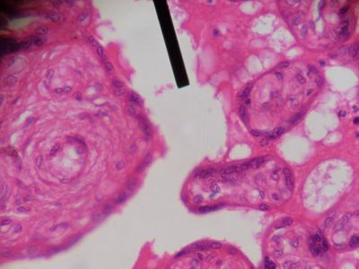 Intervillous space - histology slide
This is histology slide showing the intervillous space.

Image by Jpogi at Wikipedia, via Wikimedia Commons. Public domain.

No changes were made to the original image downloaded (note: this version was downloaded at reduced resolution from Wikimedia Commons).

