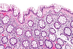 Rectum - histology slide
This is a histology slide of the rectum.

Histology slide by nephron,  via Wikimedia Commons. No changes were made from the download. 

Original file source: https://commons.wikimedia.org/wiki/File:Rectum_-_intermed_mag.jpg

This file is licensed under the Creative Commons Attribution-Share Alike 3.0 Unported license. https://creativecommons.org/licenses/by-sa/3.0/deed.en


