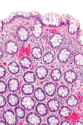 Rectum - histology slide
This is a histology slide of the rectum.

Histology slide by nephron, via Wikimedia Commons. No changes were made from the download. 

Original file source: https://commons.wikimedia.org/wiki/File:Rectum_-_intermed_mag.jpg#/media/File:Rectum_-_alt_-_intermed_mag.jpg

This file is licensed under the Creative Commons Attribution-Share Alike 3.0 Unported license. https://creativecommons.org/licenses/by-sa/3.0/deed.en

