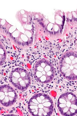 Rectum - histology slide
This is a histology slide of the rectum.

Histology slide by nephron, via Wikimedia Commons. No changes were made from the download.

Original file source: https://commons.wikimedia.org/wiki/File:Rectum_-_intermed_mag.jpg#/media/File:Rectum_-_high_mag.jpg

This file is licensed under the Creative Commons Attribution-Share Alike 3.0 Unported license. https://creativecommons.org/licenses/by-sa/3.0/deed.en


