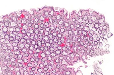 Rectum - histology slide
This is a histology slide of the rectum.

Histology slide by nephron, via Wikimedia Commons. No changes were made from the download. 

Original file source: https://commons.wikimedia.org/wiki/File:Rectum_-_low_mag.jpg

This file is licensed under the Creative Commons Attribution-Share Alike 3.0 Unported license. https://creativecommons.org/licenses/by-sa/3.0/deed.en

