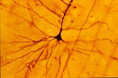 Pyramidal neuron - histology slide
A human neocortical pyramidal cell stained via Golgi's method (description text from the Wikimedia Commons file page).

Photo by Bob Jacobs, Laboratory of Quantitative Neuromorphology Department of Psychology Colorado College.

Transferred from en.wikipedia to Wikimedia Commons.
The original uploader was Cahass at English Wikipedia.

File source: [url=https://commons.wikimedia.org/wiki/File:GolgiStainedPyramidalCell.jpg]https://commons.wikimedia.org/wiki/File:GolgiStainedPyramidalCell.jpg[/url]  

Title: "GolgiStainedPyramidalCell.jpg"

No changes were made to the original image downloaded.  

This file is licensed under the Creative Commons Attribution-ShareAlike 3.0 Unported License (CC BY-SA 3.0) [url=https://creativecommons.org/licenses/by-sa/3.0/deed.en/]https://creativecommons.org/licenses/by-sa/3.0/deed.en/[/url]

Permission is granted to copy, distribute and/or modify this document under the terms of the GNU Free Documentation License, Version 1.2 or any later version published by the Free Software Foundation; with no Invariant Sections, no Front-Cover Texts, and no Back-Cover Texts. A copy of the license is included in the section entitled GNU Free Documentation License. Subject to disclaimers. [url=https://commons.wikimedia.org/wiki/Commons:GNU_Free_Documentation_License,_version_1.2]https://commons.wikimedia.org/wiki/Commons:GNU_Free_Documentation_License,_version_1.2[/url]

This file is licensed under the Creative Commons Attribution-ShareAlike 2.5 Generic license [url=https://creativecommons.org/licenses/by-sa/2.5/deed.en/]https://creativecommons.org/licenses/by-sa/2.5/deed.en/[/url]

