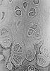 Hypertrophic_Zone_of_Epiphyseal_Plate.jpg