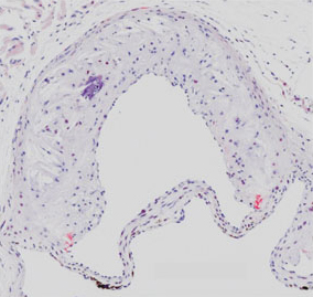 Heart Valve Histology