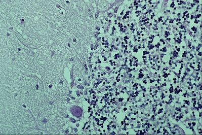 Normal Brain Histology