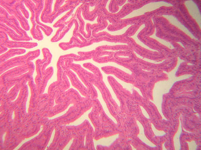 Seminal vesicle - histology slide Seminal vesicle - histology slide