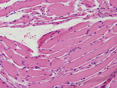 normal_skeletalmuscle4.jpg