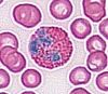 3eosinophil.jpg