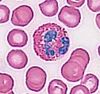 4eosinophil.jpg