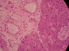 800px-WVSOM_Parotid_Gland1.jpg