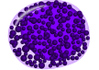 Basophilic_myelocyte.png