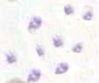 Blood_platelets.jpg