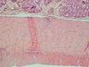 Duodenum-100x-2.jpg