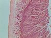 Duodenum-100x-3.jpg