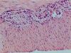 Duodenum-400x-2.jpg