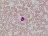 Eosinophil-1.jpg