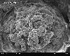 Glomerulum_of_mouse_kidney_in_Scanning_Electron_Microscope,_magnification_1,000x.gif