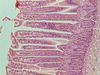 Ileum-forvilli-100x.jpg