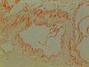 LymphaticVessel-400x-2.jpg