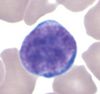 Lymphocyte_GL.jpg