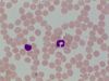 Neutrophil-CshapedNucleus.jpg