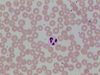 Neutrophil-drumstick-1.jpg