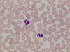 Neutrophils.jpg