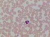 Neutrophil~0.jpg