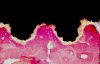 Filename=Osseointegration_Histology.jpg
Filesize=543KiB
Dimensions=1614x1049
Date added=Sep 19, 2008 Osseointegration_Histology.jpg