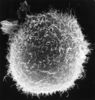 SEM-macrophagelymphocyte.jpg