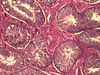 Testicle-histology-boar.jpg