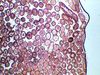 Testis-1-40x.jpg