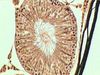 Testis-3-400x-2.jpg