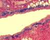 Filename=Trichrome.gif
Filesize=15KiB
Dimensions=150x121
Date added=Sep 07, 2007 Trichrome.gif