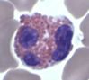 WBC_eosinophil.jpg